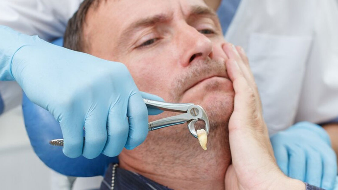 Tooth Extraction - Dental Icon